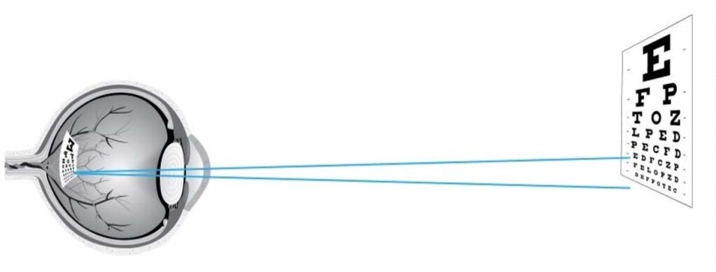Visual Acuity Explained - Activu Corporation
